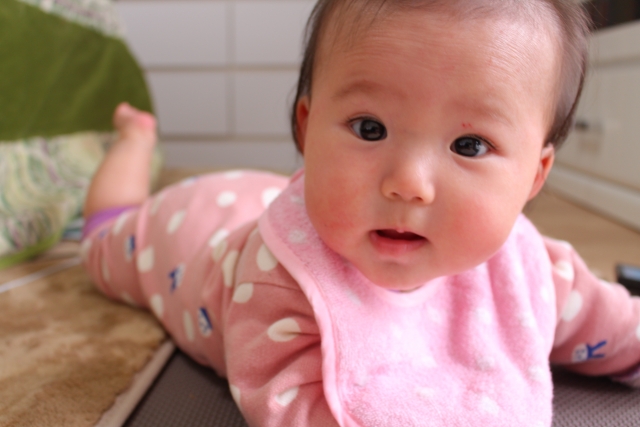 赤ちゃんの顔の湿疹はひどくなりやすい？